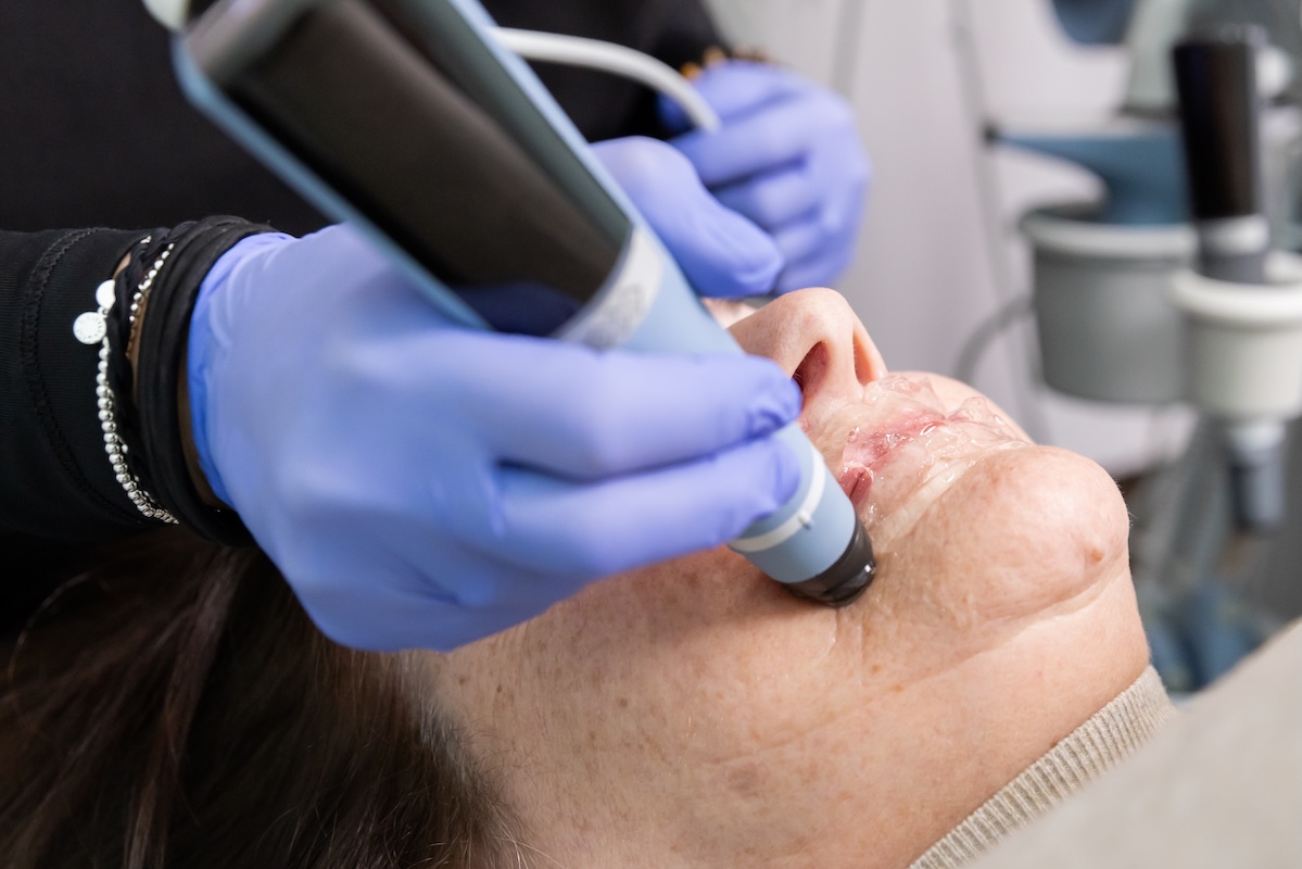 Exion Skin Rejuvenation