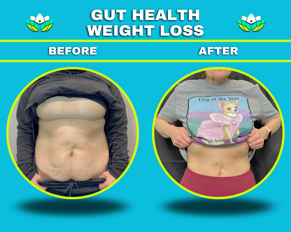 Weight Loss