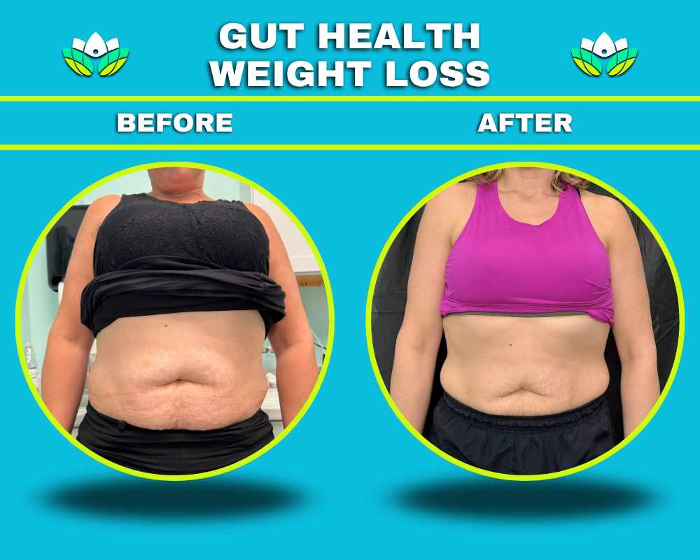 Weight Loss - Female
