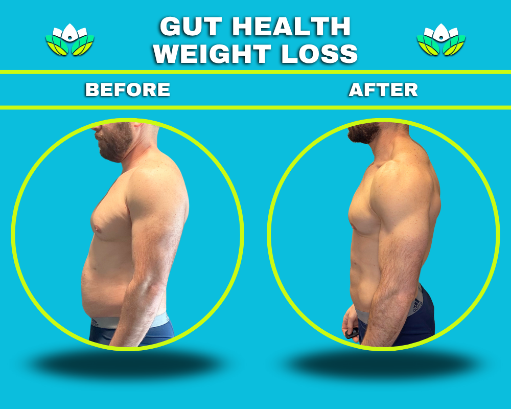 Weight Loss
