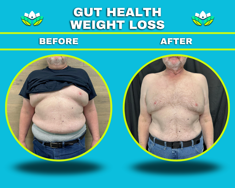 Weight Loss