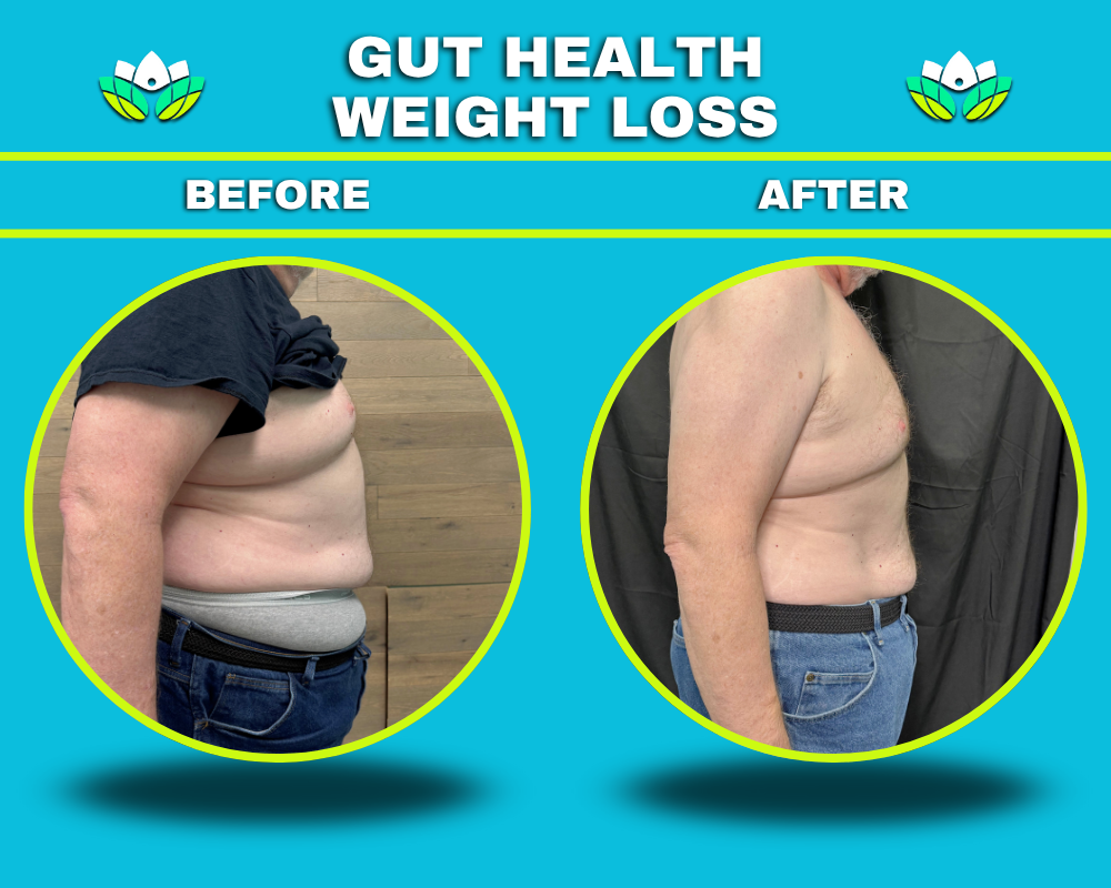 Before and after weight loss comparison showing reduced belly fat through a gut health weight loss program at Iowa Wellness Center, which includes exercise recommendations and medications such as semaglutide near Cedar Rapids.