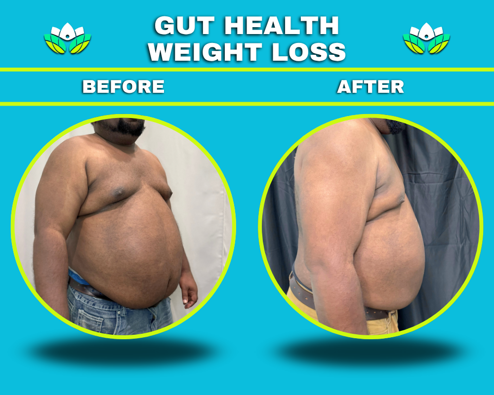 Weight Loss