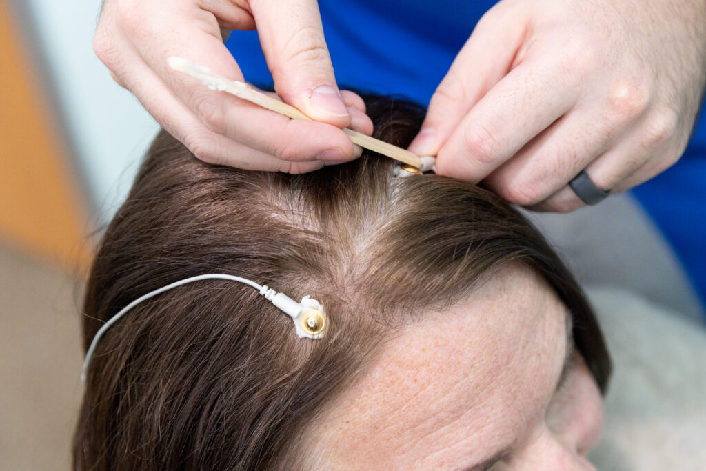 Provider places electrodes onto patient's scalp as part of a session for neuromapping in North Liberty.